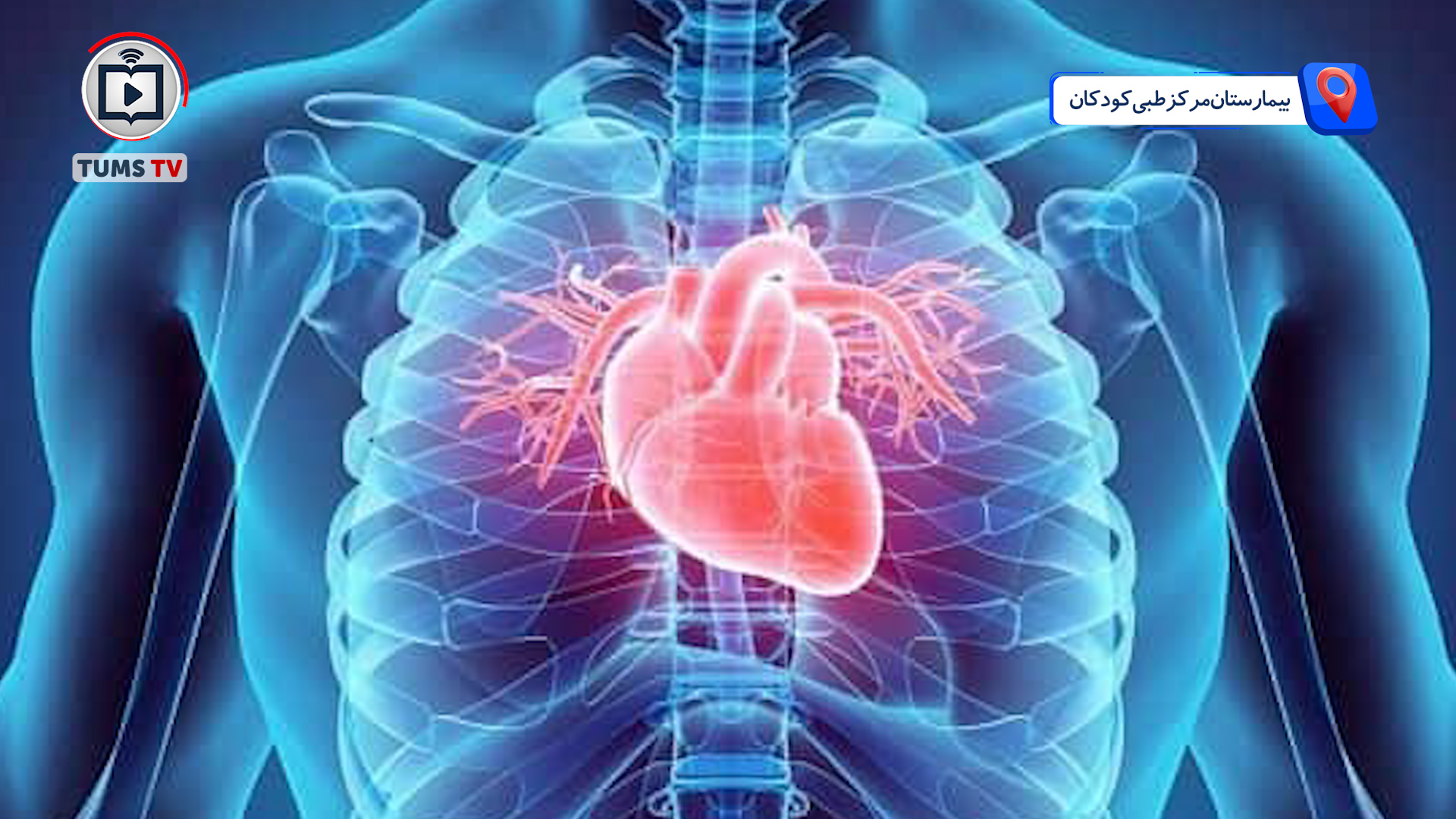 کارنامه موفق عمل جراحی کم‌تهاجمی قلب کودکان در بیمارستان مرکز طبی کودکان